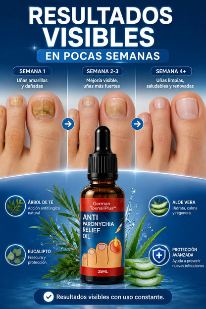 German Plus™ | Elimina Hongos y Recupera Tus Uñas